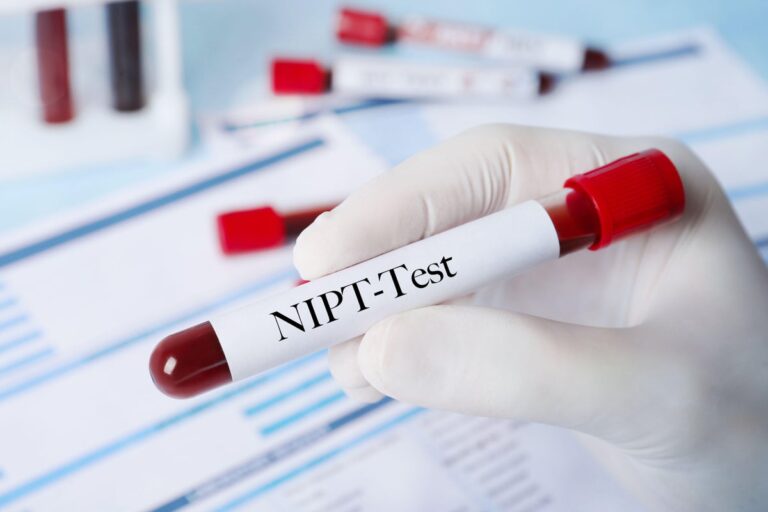 Noninvasive prenatal testing NIPT